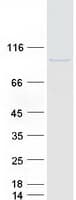 Human KIAA1958 Protein (Recombinant Myc-DDK (Flag))