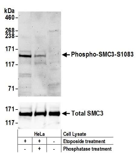 SMC3 / HCAP Antibody (phospho-Ser1083)
