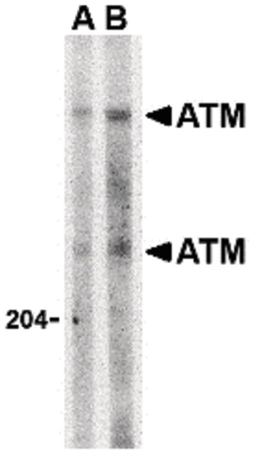 IHC-plus™ ATM Antibody