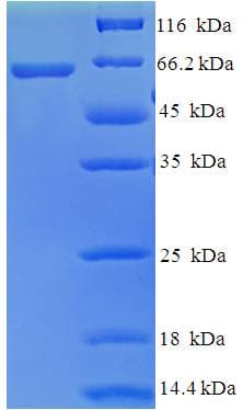 Human AMDHD1 Protein (Recombinant His-SUMO)