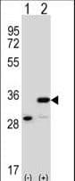 PHB / Prohibitin Antibody (aa89-117)