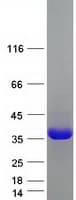 Human SPP1 / Osteopontin Protein (Recombinant Myc-DDK (Flag))