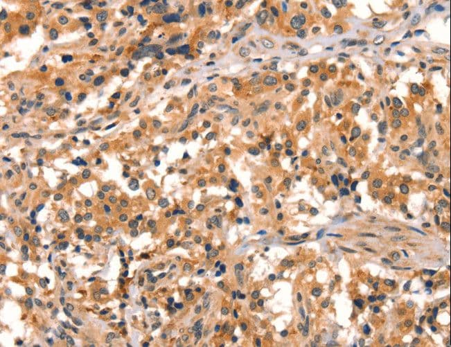 SPINLW1 / EPPIN Antibody