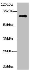 GLS / Glutaminase Antibody