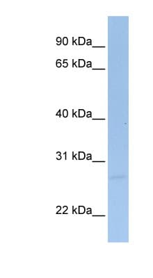 SIGIRR Antibody (C-Terminus)
