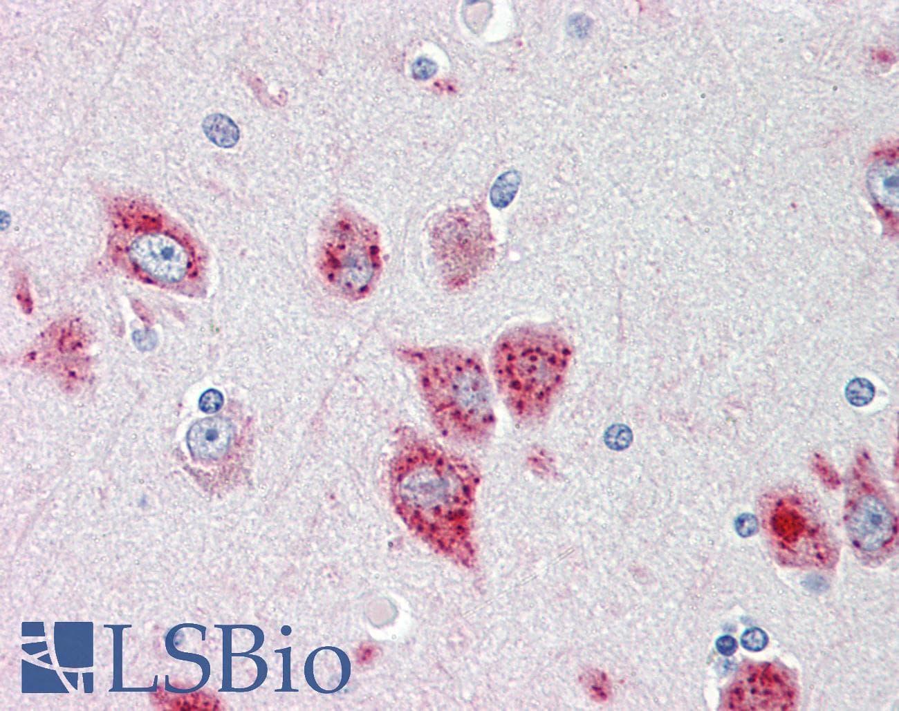 IHC-plus™ Polyclonal Rabbit anti-Human ANKH Antibody (aa464-492, IHC, WB)