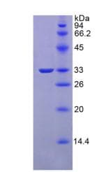 Rat FLT1 / VEGFR1 Protein (Recombinant His-S)