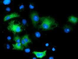 MAPK12 / ERK6 / SAPK3 Antibody (clone OTI4D6)
