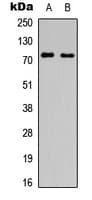 SLC6A16 Antibody (Internal)