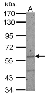 IKZF2 / HELIOS Antibody