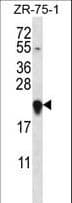 GAGE12H Antibody (aa21-49)