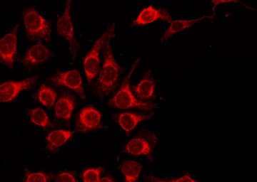 AGER / RAGE Antibody