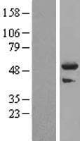 TRIM44 Protein (Over-Expression Lysate Myc-DDK (Flag))