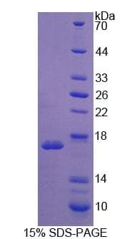 Mouse CCN4 / WISP1 Protein (Recombinant His)