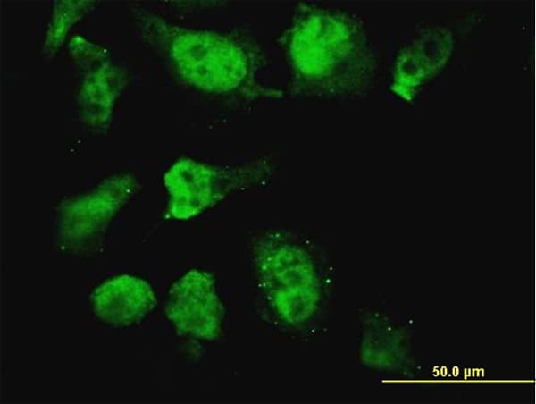HOXD11 Antibody (clone 6C8)