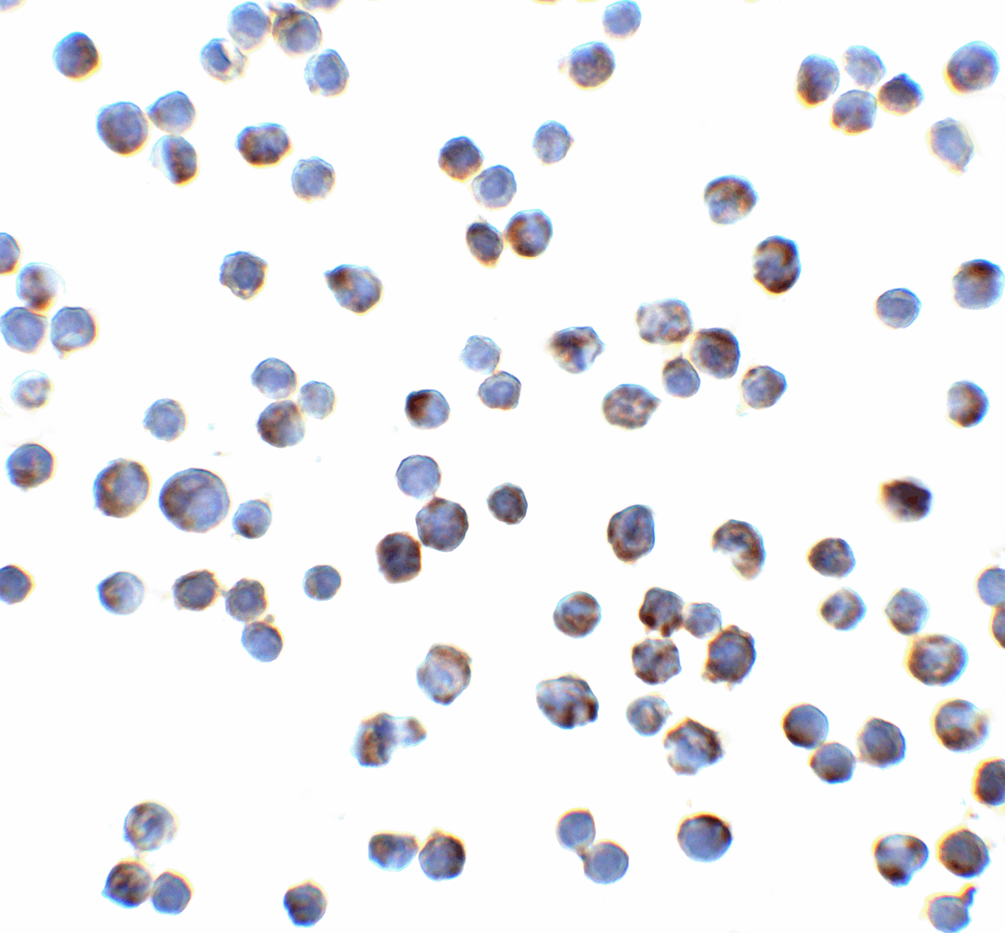IHC-plus™ Polyclonal Rabbit anti-Human TNFRSF10A / DR4 Antibody (IHC, IF, WB)
