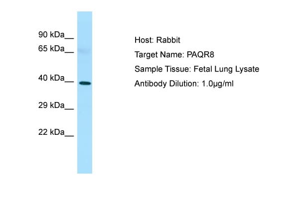 LMPB1 / PAQR8 Antibody (C-Terminus)