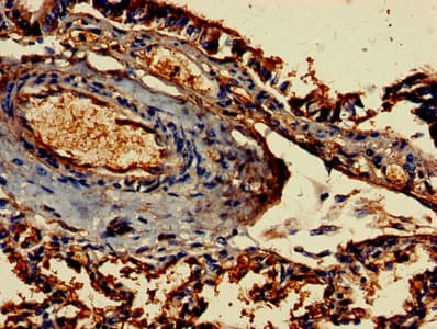 Polyclonal Rabbit anti-Human FCER1G Antibody (WB)