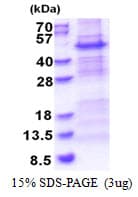 Human NDUFS2 Protein (Recombinant His)