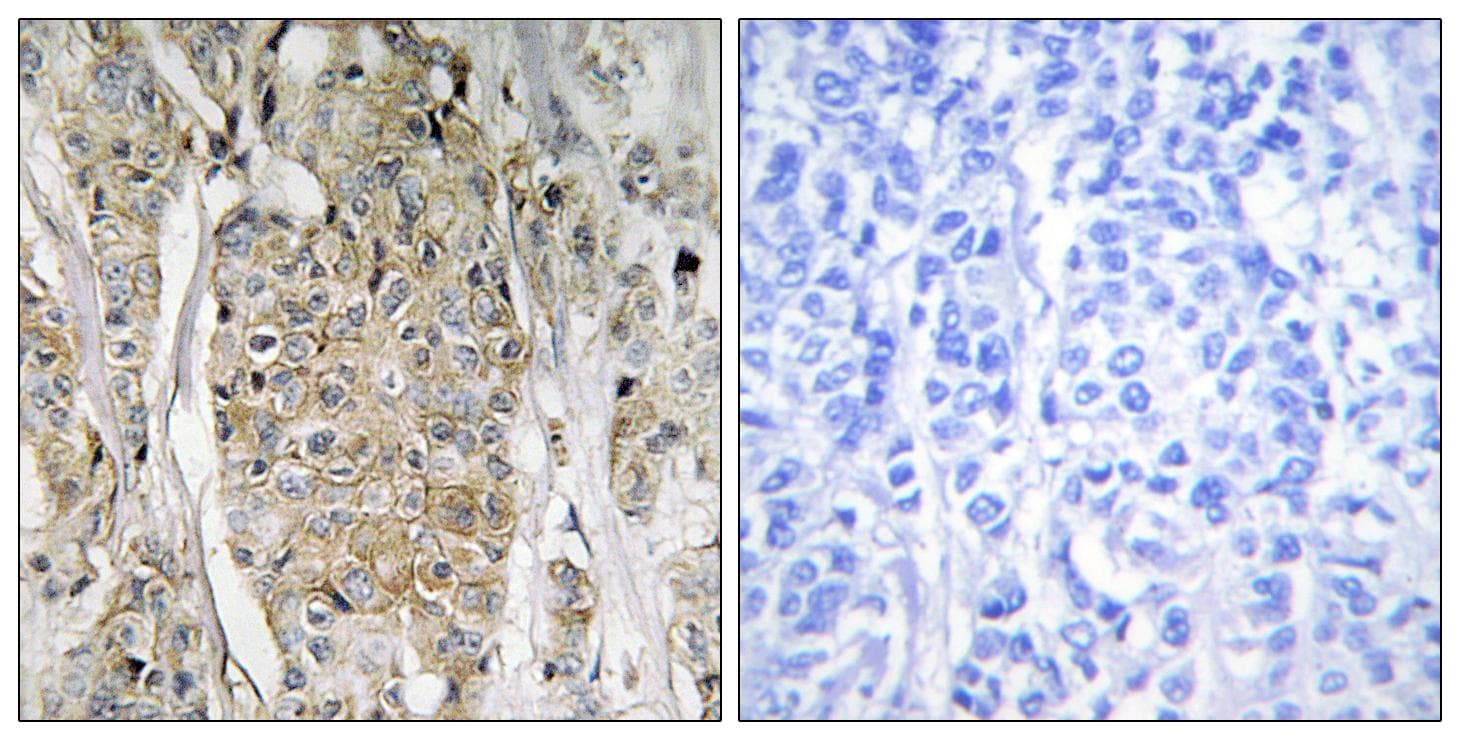 ERBB2 / HER2 Antibody