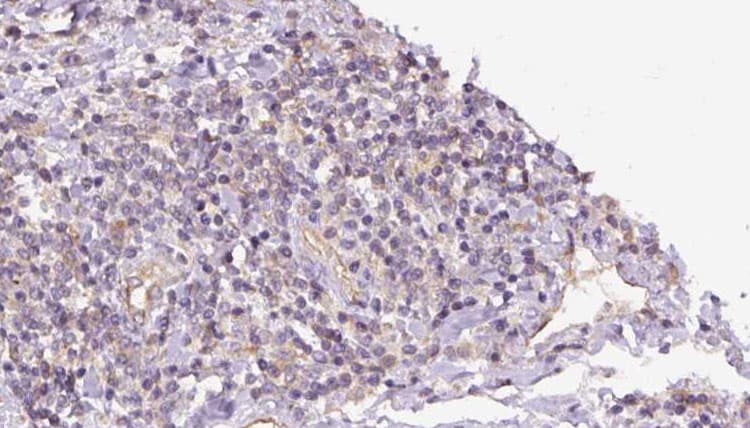 Polyclonal Rabbit anti-Human GPBB / PYGB Antibody (IHC, WB)