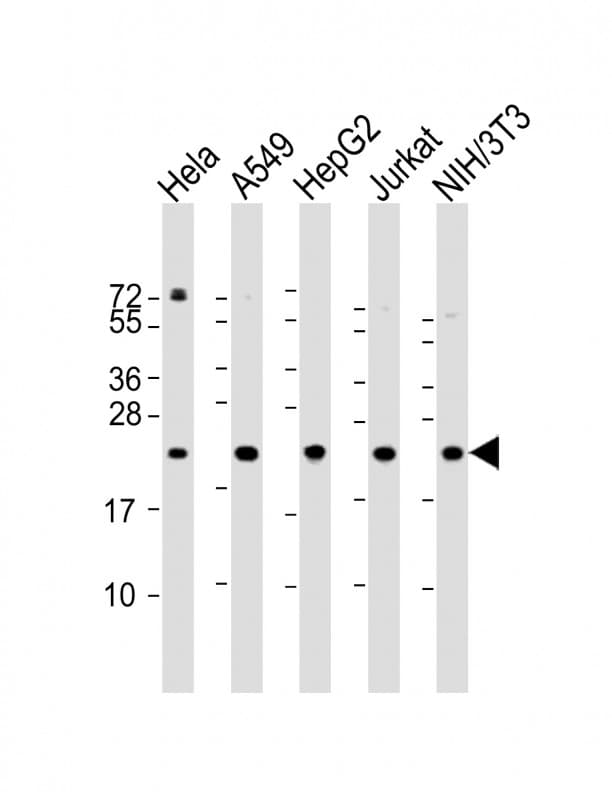 Polyclonal Rabbit anti-Human RPS7 / Ribosomal Protein S7 Antibody (N-Terminus, WB)