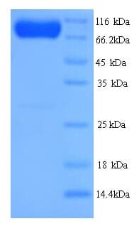 Human SMURF2 Protein (Recombinant 6His, N-terminus)