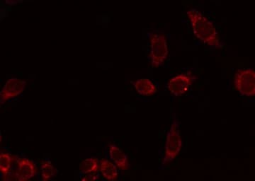 Polyclonal Rabbit anti-Human ADGRE4P / EMR4P Antibody (IF, WB)