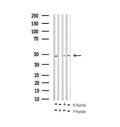 Polyclonal Rabbit anti-Human E2F1 Antibody (phospho-Thr433, IF, WB)