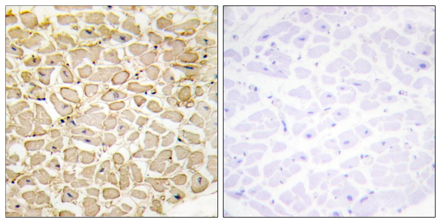 CDH13 / Cadherin 13 Antibody