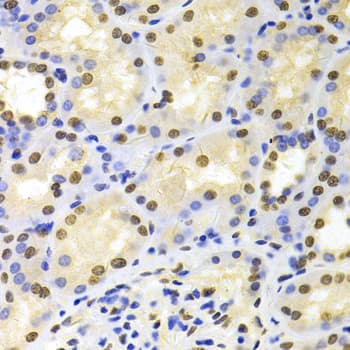 HDGF Antibody