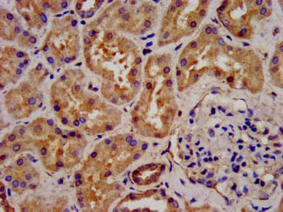 Polyclonal Rabbit anti-Human C6orf134 / ATAT1 Antibody (IHC, WB)