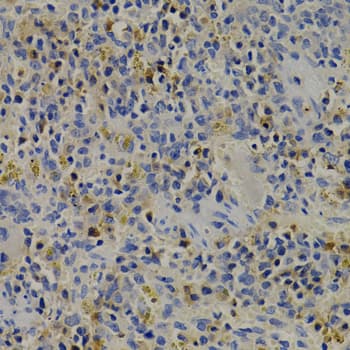 IGFBP1 Antibody
