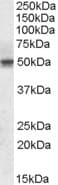 IHC-plus™ Polyclonal Goat anti-Human SEPT6 / Septin 6 Antibody (aa523-534, IHC, WB)