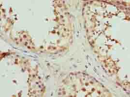 Polyclonal Rabbit anti-Human MAT2A Antibody (IHC)