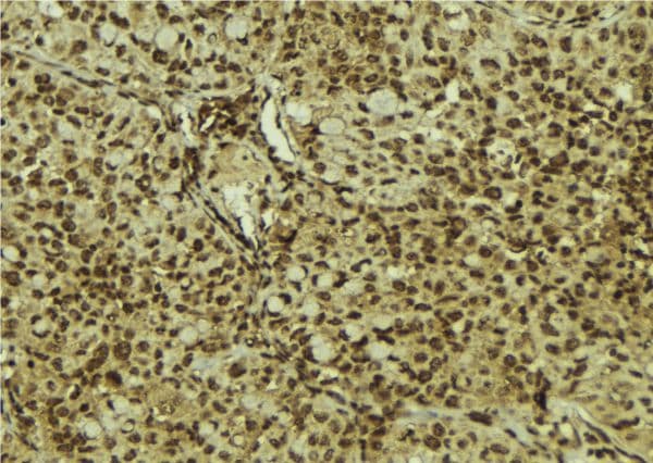 IPPK Antibody