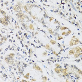 RETN / Resistin Antibody