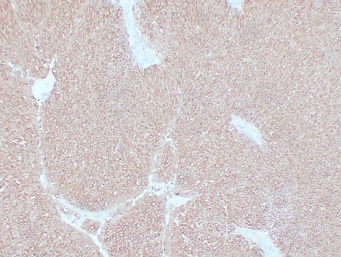 IHC-plus™ Monoclonal Mouse anti-Human KRT7 / CK7 / Cytokeratin 7 Antibody (clone ABT-CK7, IHC, WB)