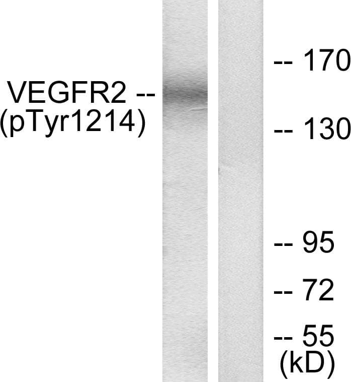 KDR / VEGFR2 / FLK1 Antibody (phospho-Tyr1214)