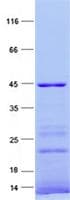 Human BLNK Protein (Recombinant His, N-Terminal)