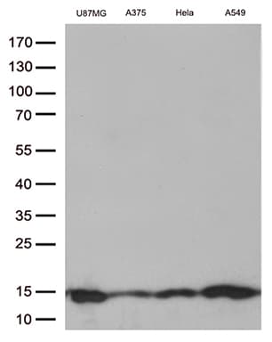 CSTB / Cystatin B / Stefin B Antibody (aa1-98, clone OTI1F12)
