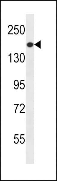 PREX1 / P-REX1 Antibody (aa1134-1163)