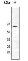 Polyclonal Rabbit anti-Human ER Alpha / Estrogen Receptor Antibody (IHC, WB)