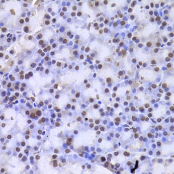 CSNK1E / CK1 Epsilon Antibody