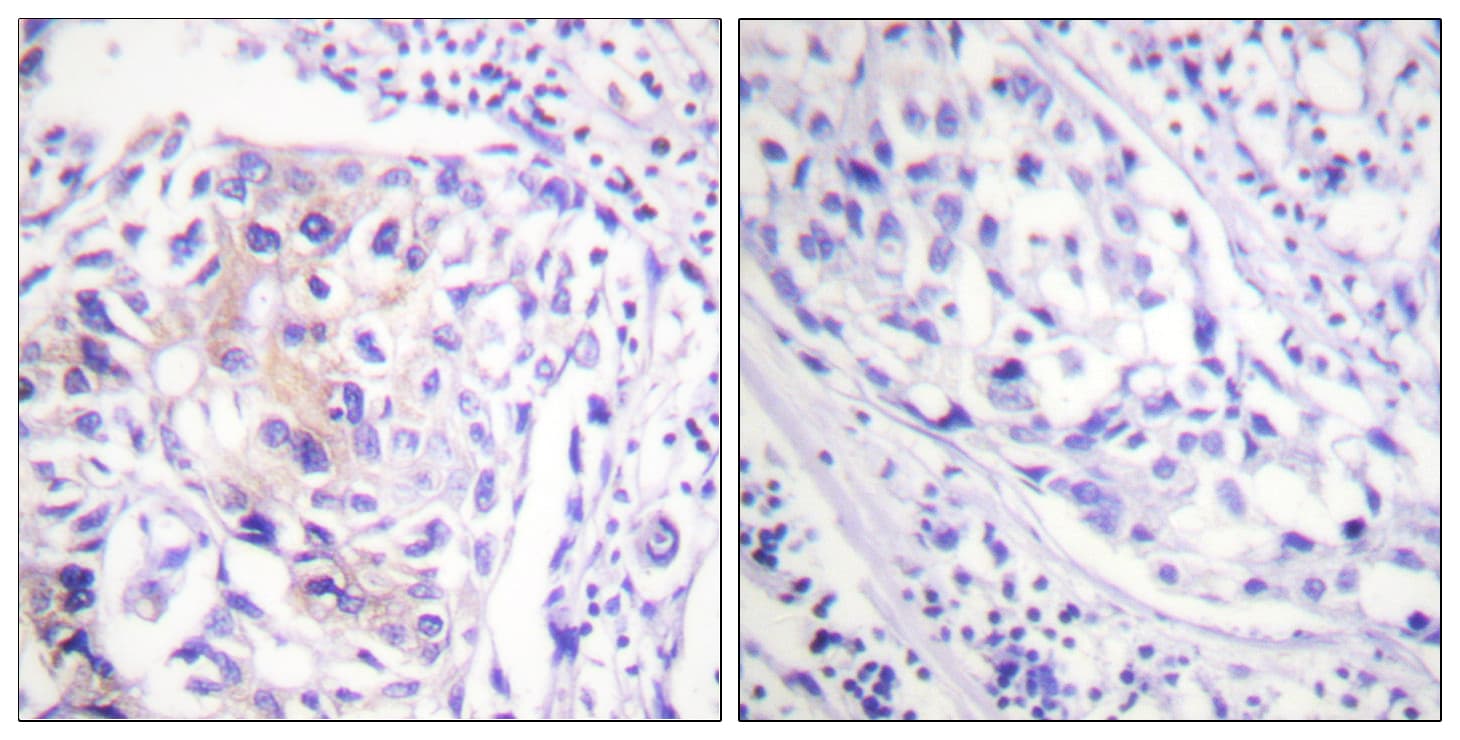 c-CBL Antibody (phospho-Tyr774)