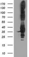 P5CR2 / PYCR2 Antibody (clone OTI5C7)
