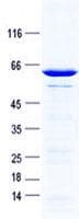 Human MRPS35 Protein (Recombinant GST, N-terminus + His, C-terminus)