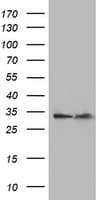 EXOSC7 Antibody (clone OTI3B2)