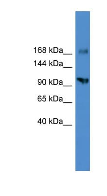 AXL Antibody (C-Terminus)