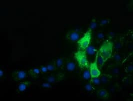 Alpha-Fetoprotein Antibody (clone OTI2A9)